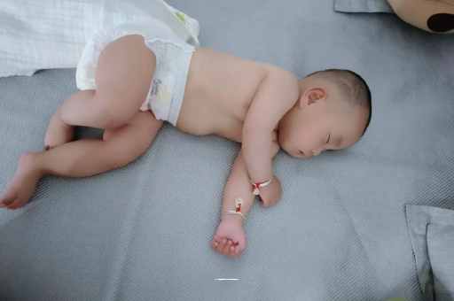乳山六个月宝宝眼睛散光